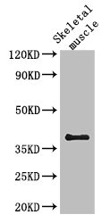 SLC29A1 / ENT1 Antibody - Positive WB detected in:Mouse skeletal muscle tissue;All lanes: KIR2DL3 antibody at 2.7ug/ml;Secondary;Goat polyclonal to rabbit IgG at 1/50000 dilution;Predicted band size: 51,59 kDa;Observed band size: 38 kDa;