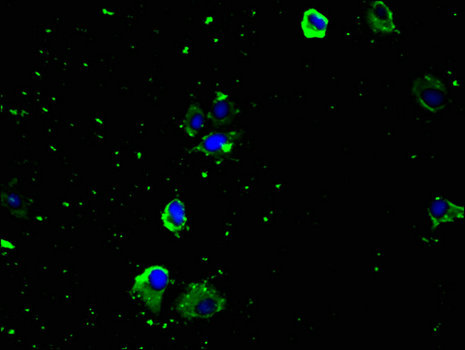 SLC29A1 / ENT1 Antibody - Immunofluorescent analysis of U251 cells using SLC29A1 Antibody at a dilution of 1:100 and Alexa Fluor 488-congugated AffiniPure Goat Anti-Rabbit IgG(H+L)