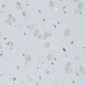 SLC29A1 / ENT1 Antibody - Immunohistochemistry of paraffin-embedded rat brain using SLC29A1 antibody at dilution of 1:100 (40x lens).