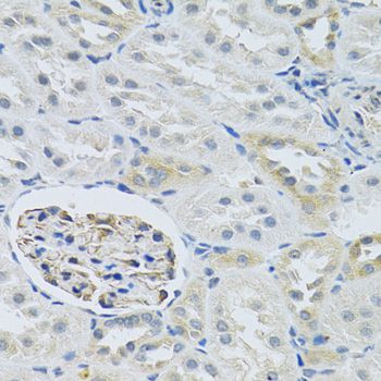 SLC29A1 / ENT1 Antibody - Immunohistochemistry of paraffin-embedded rat kidney using SLC29A1 antibody at dilution of 1:100 (40x lens).