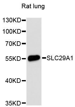 SLC29A1 / ENT1 Antibody - Western blot analysis of extracts of rat lung, using SLC29A1 antibody at 1:3000 dilution. The secondary antibody used was an HRP Goat Anti-Rabbit IgG (H+L) at 1:10000 dilution. Lysates were loaded 25ug per lane and 3% nonfat dry milk in TBST was used for blocking. An ECL Kit was used for detection and the exposure time was 90s.