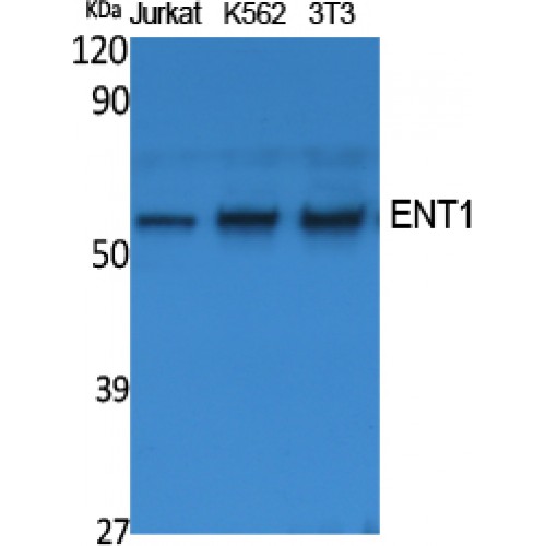 SLC29A1 / ENT1 Antibody - Western blot of ENT1 antibody
