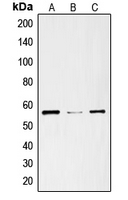 SLC29A1 / ENT1 Antibody - Western blot analysis of ENT1 expression in SKNSH (A); mouse heart (B); rat heart (C) whole cell lysates.