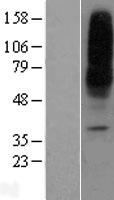 SLC29A1 / ENT1 Protein - Western validation with an anti-DDK antibody * L: Control HEK293 lysate R: Over-expression lysate