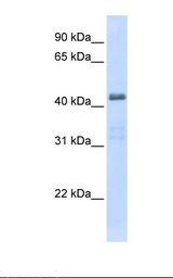 SLC29A2 / ENT2 Antibody - Transfected 293T cell lysate. Antibody concentration: 1.0 ug/ml. Gel concentration: 12%.  This image was taken for the unconjugated form of this product. Other forms have not been tested.