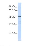 SLC29A2 / ENT2 Antibody - Transfected 293T cell lysate. Antibody concentration: 1.0 ug/ml. Gel concentration: 12%.  This image was taken for the unconjugated form of this product. Other forms have not been tested.