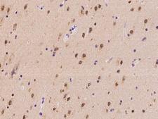 SLC29A2 / ENT2 Antibody - Immunochemical staining of human SLC29A2 in human brain with rabbit polyclonal antibody at 1:100 dilution, formalin-fixed paraffin embedded sections.