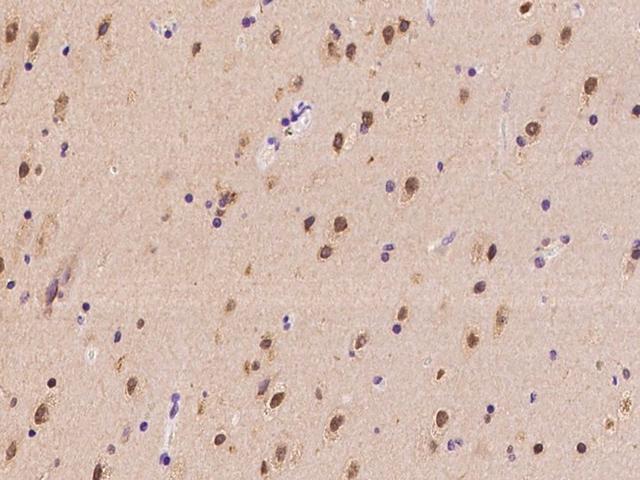 SLC29A2 / ENT2 Antibody - Immunochemical staining of human SLC29A2 in human brain with rabbit polyclonal antibody at 1:100 dilution, formalin-fixed paraffin embedded sections.