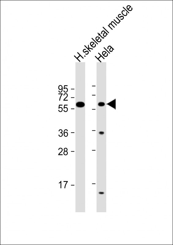 SLC29A2 / ENT2 Antibody - All lanes: Anti-SLC29A2 Antibody (N-Term) at 1:2000 dilution Lane 1: human skeletal muscle lysate Lane 2: Hela whole cell lysate Lysates/proteins at 20 µg per lane. Secondary Goat Anti-Rabbit IgG, (H+L), Peroxidase conjugated at 1/10000 dilution. Predicted band size: 50 kDa Blocking/Dilution buffer: 5% NFDM/TBST.