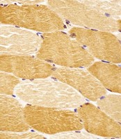 SLC29A2 / ENT2 Antibody - SLC29A2 Antibody (N-Term) staining SLC29A2 in human skeletal muscle tissue sections by Immunohistochemistry (IHC-P - paraformaldehyde-fixed, paraffin-embedded sections). Tissue was fixed with formaldehyde and blocked with 3% BSA for 0. 5 hour at room temperature; antigen retrieval was by heat mediation with a citrate buffer (pH6). Samples were incubated with primary antibody (1/25) for 1 hours at 37°C. A undiluted biotinylated goat polyvalent antibody was used as the secondary antibody.