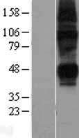 SLC29A2 / ENT2 Protein - Western validation with an anti-DDK antibody * L: Control HEK293 lysate R: Over-expression lysate