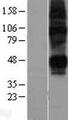SLC29A2 / ENT2 Protein - Western validation with an anti-DDK antibody * L: Control HEK293 lysate R: Over-expression lysate