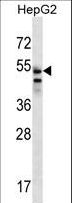 SLC29A3 / ENT3 Antibody - SLC29A3 Antibody western blot of HepG2 cell line lysates (35 ug/lane). The SLC29A3 antibody detected the SLC29A3 protein (arrow).