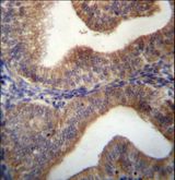 SLC29A3 / ENT3 Antibody - SLC29A3 Antibody immunohistochemistry of formalin-fixed and paraffin-embedded human uterus tissue followed by peroxidase-conjugated secondary antibody and DAB staining.