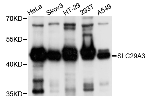 SLC29A3 / ENT3 Antibody - Western blot analysis of extracts of various cell lines, using SLC29A3 antibody at 1:1000 dilution. The secondary antibody used was an HRP Goat Anti-Rabbit IgG (H+L) at 1:10000 dilution. Lysates were loaded 25ug per lane and 3% nonfat dry milk in TBST was used for blocking. An ECL Kit was used for detection and the exposure time was 5s.