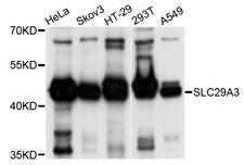 SLC29A3 / ENT3 Antibody - Western blot analysis of extracts of various cell lines, using SLC29A3 antibody at 1:1000 dilution. The secondary antibody used was an HRP Goat Anti-Rabbit IgG (H+L) at 1:10000 dilution. Lysates were loaded 25ug per lane and 3% nonfat dry milk in TBST was used for blocking. An ECL Kit was used for detection and the exposure time was 5s.