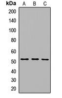 SLC29A3 / ENT3 Antibody - Western blot using A, HeLa cells; B, HT29 cells; C, A459 cells. Antibody dilution 1:500.