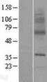 SLC29A3 / ENT3 Protein - Western validation with an anti-DDK antibody * L: Control HEK293 lysate R: Over-expression lysate