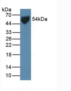 SLC2A1 / GLUT-1 Antibody - Western Blot; Sample: Human Serum.