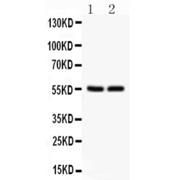 SLC2A1 / GLUT-1 Antibody - SLC2A1 antibody Western blot. All lanes: Anti SLC2A1 at 0.5 ug/ml. Lane 1: HELA Whole Cell Lysate at 40 ug. Lane 2: JURKAT Whole Cell Lysate at 40 ug. Predicted band size: 55 kD. Observed band size: 55 kD.