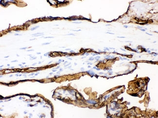 SLC2A1 / GLUT-1 Antibody