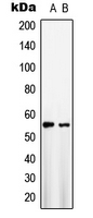 SLC2A1 / GLUT-1 Antibody - Western blot analysis of GLUT1 expression in HepG2 (A); NIH3T3 (B) whole cell lysates.