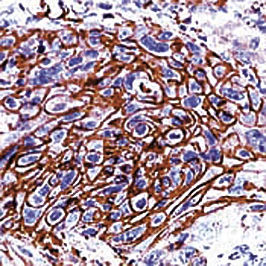 SLC2A1 / GLUT-1 Antibody - Formalin-fixed, paraffin-embedded human esophagus stained with GLUT-1 antibody.