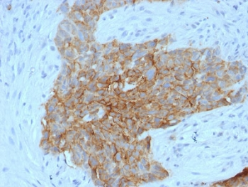 SLC2A1 / GLUT-1 Antibody - IHC testing of human tongue with GLUT1 antibody (clone GLUT1/2475). Required HIER: boil tissue sections in 10mM citrate buffer, pH 6, for 10-20 min followed by cooling at RT for 20 min.