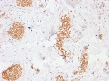 SLC2A1 / GLUT-1 Antibody - IHC testing of human bladder with GLUT1 antibody (clone GLUT1/2476). Required HIER: boil tissue sections in 10mM citrate buffer, pH 6, for 10-20 min followed by cooling at RT for 20 min.