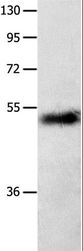 SLC2A1 / GLUT-1 Antibody - Western blot analysis of Human seminoma tissue, using SLC2A1 Polyclonal Antibody at dilution of 1:850.