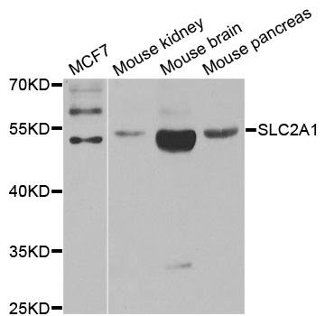 SLC2A1 / GLUT-1 Antibody - Western blot analysis of extracts of various cell lines.