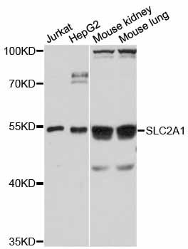 SLC2A1 / GLUT-1 Antibody - Western blot analysis of extracts of various cell lines, using SLC2A1 antibody at 1:1000 dilution. The secondary antibody used was an HRP Goat Anti-Rabbit IgG (H+L) at 1:10000 dilution. Lysates were loaded 25ug per lane and 3% nonfat dry milk in TBST was used for blocking. An ECL Kit was used for detection and the exposure time was 20s.