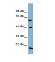 SLC2A10 / GLUT10 Antibody - Western blot of Human NCI-H226. SLC2A10 antibody dilution 1.0 ug/ml.  This image was taken for the unconjugated form of this product. Other forms have not been tested.