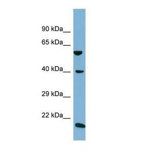 SLC2A10 / GLUT10 Antibody - Western blot of Human NCI-H226. SLC2A10 antibody dilution 1.0 ug/ml.  This image was taken for the unconjugated form of this product. Other forms have not been tested.