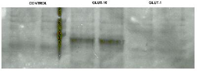 SLC2A10 / GLUT10 Antibody - NCI-H1299 non-small cell lung tumor cells were transfected with the eukaryotic expression vectors pcDNA3.1/V5 (lanes 1,2), pCMV-GLUT10 (lanes 3,4), and pCMV-GLUT1 (lanes 5,6). GLUT10 was detected using GLUT10 (Glucose Transporter 10) Antibody.