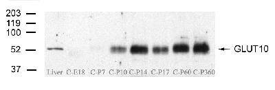 SLC2A10 / GLUT10 Antibody - Cochlea from embryonic mice and mice up to 1 year old were removed and the pure membrane fraction loaded on 4-20% SDS gel, Following electrophoresis, transfer and blocking, the blot was incubated overnight at 4 degrees C with the GLUT10 primary antibody at a 1:500 dilution followed by incubation with secondary antibody at a 1:3000 dilution for 1 h at room temperature. Protein bands were visualized on x-ray film with SuperSignal west Femto chemiluminescent substrate. Lanes contain 10 ug of protein.