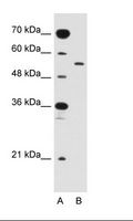 SLC2A10 / GLUT10 Antibody - A: Marker, B: Jurkat Cell Lysate.  This image was taken for the unconjugated form of this product. Other forms have not been tested.