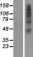 SLC2A11 / GLUT11 Protein - Western validation with an anti-DDK antibody * L: Control HEK293 lysate R: Over-expression lysate