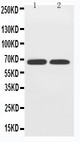 SLC2A12 / GLUT12 Antibody - WB of SLC2A12 / GLUT12 antibody. Lane 1: PC-12 Cell Lysate. Lane 2: A549 Cell Lysate.