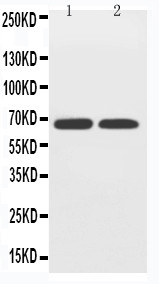 SLC2A12 / GLUT12 Antibody - WB of SLC2A12 / GLUT12 antibody. Lane 1: PC-12 Cell Lysate. Lane 2: A549 Cell Lysate.