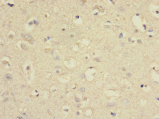 SLC2A13 / HMIT / GLUT13 Antibody - Immunohistochemistry of paraffin-embedded human brain tissue at dilution 1:100