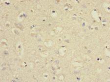 SLC2A13 / HMIT / GLUT13 Antibody - Immunohistochemistry of paraffin-embedded human brain tissue at dilution 1:100