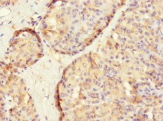 SLC2A13 / HMIT / GLUT13 Antibody - Immunohistochemistry of paraffin-embedded human pancreatic tissue at dilution 1:100