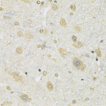 SLC2A13 / HMIT / GLUT13 Antibody - Immunohistochemistry of paraffin-embedded Mouse spinal cord using SLC2A13 Polyclonal Antibody at dilution of 1:100 (40x lens).