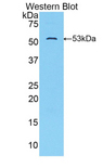 SLC2A14 Antibody - Western blot of SLC2A14 antibody.