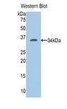 SLC2A14 Antibody - Western blot of recombinant SLC2A14.  This image was taken for the unconjugated form of this product. Other forms have not been tested.