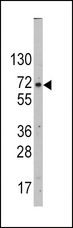 SLC2A2 / GLUT2 Antibody - Western blot of SLC2A2 Antibody in HepG2 cell line lysates (35 ug/lane). SLC2A2 (arrow) was detected using the purified antibody.