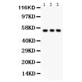 SLC2A2 / GLUT2 Antibody - SLC2A2 antibody Western blot. All lanes: Anti SLC2A2 at 0.5 ug/ml. Lane 1: PANC Whole Cell Lysate at 40 ug. Lane 2: A549 Whole Cell Lysate at 40 ug. Lane 3: HT1080 Whole Cell Lysate at 40 ug. Predicted band size: 57 kD. Observed band size: 50 kD.