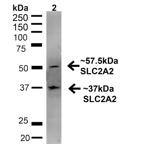 SLC2A2 / GLUT2 Antibody - Western blot analysis of Rat Liver showing detection of ~57.5kDa GLUT2 protein using Rabbit Anti-GLUT2 Polyclonal Antibody. Lane 1: MW Ladder. Lane 2: Rat Liver (20 µg). Load: 20 µg. Block: 5% milk + TBST for 1 hour at RT. Primary Antibody: Rabbit Anti-GLUT2 Polyclonal Antibody  at 1:1000 for 1 hour at RT. Secondary Antibody: Goat Anti-Rabbit: HRP at 1:2000 for 1 hour at RT. Color Development: TMB solution for 12 min at RT. Predicted/Observed Size: ~57.5kDa. Other Band(s): ~37kDa.