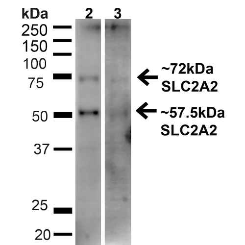 SLC2A2 / GLUT2 Antibody - Western blot analysis of Human HeLa and HEK293T cell lysates showing detection of ~57.5kDa GLUT2 protein using Rabbit Anti-GLUT2 Polyclonal Antibody. Lane 1: MW Ladder. Lane 2: Human HeLa (20 µg). Lane 3: Human 293T (20 µg). Load: 20 µg. Block: 5% milk + TBST for 1 hour at RT. Primary Antibody: Rabbit Anti-GLUT2 Polyclonal Antibody  at 1:1000 for 1 hour at RT. Secondary Antibody: Goat Anti-Rabbit: HRP at 1:2000 for 1 hour at RT. Color Development: TMB solution for 12 min at RT. Predicted/Observed Size: ~57.5kDa. Other Band(s): ~72kDa.